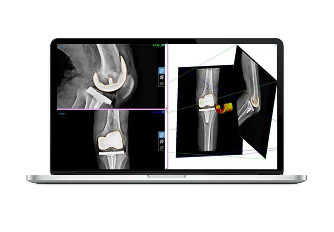 Программный продукт Materialise Mimics Innovation Suite (MIS)