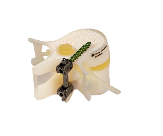 Stratasys BoneMatrix
