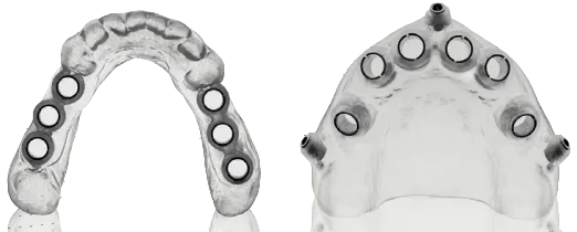 Фотополимерная смола Нолатек 3D LCD/DLP для изготовления ортодонтических и диагностических моделей, полупрозрачная, 1кг