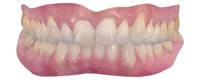 3d-skaner-3shape-trios-wireless-3.jpg 3d-skaner-3shape-trios-wireless-3.jpg