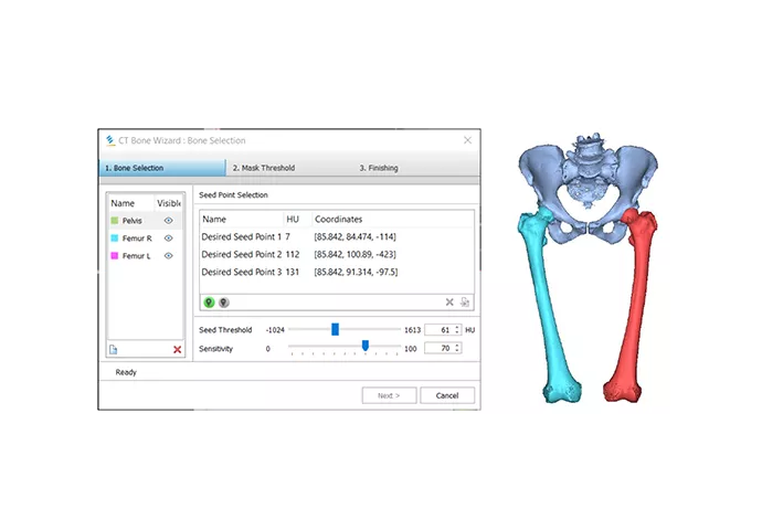 Программный продукт Materialise Mimics Innovation Suite (MIS)