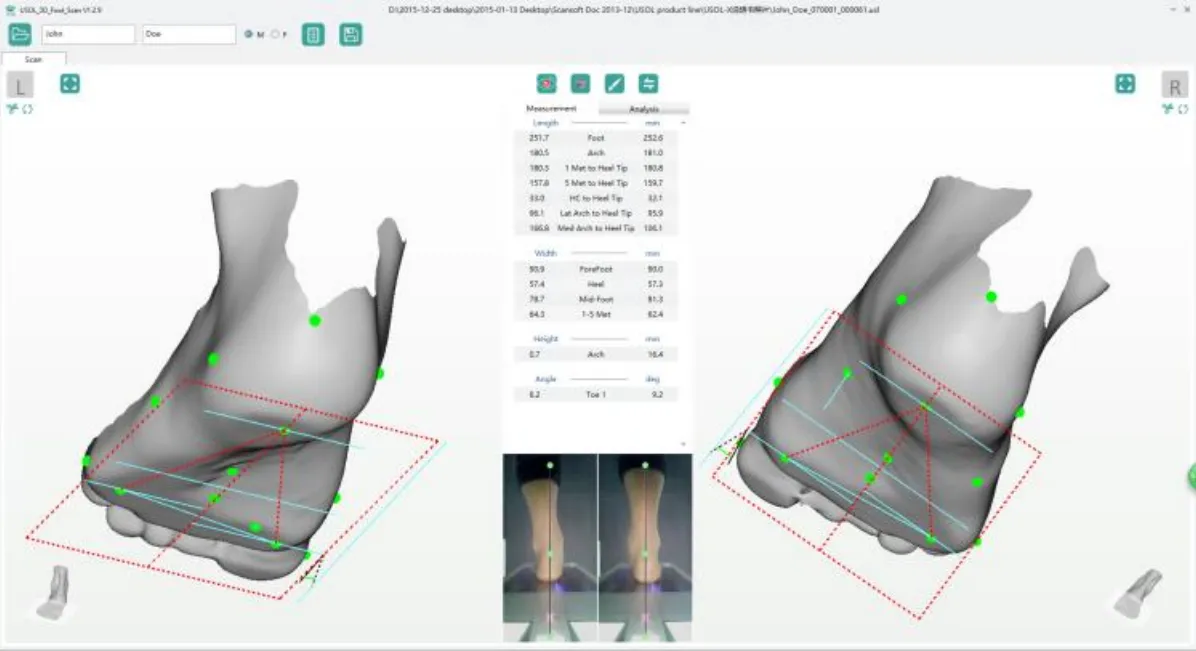 Ортопедический сканер ScanPod3D USOL-X Floor