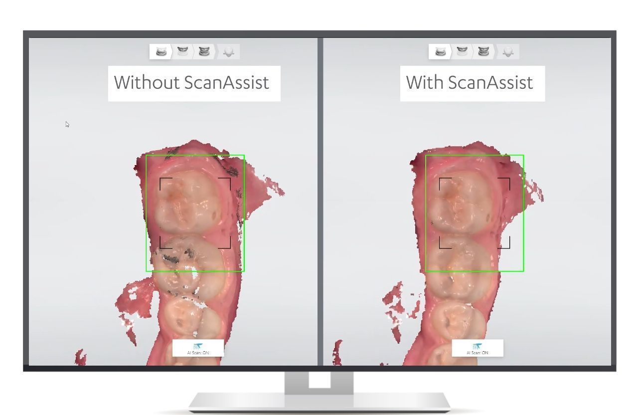 Интраоральный 3D-сканер 3Shape TRIOS 5