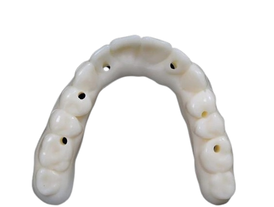 Stratasys KeyDenture Try-In by Keystone Industries