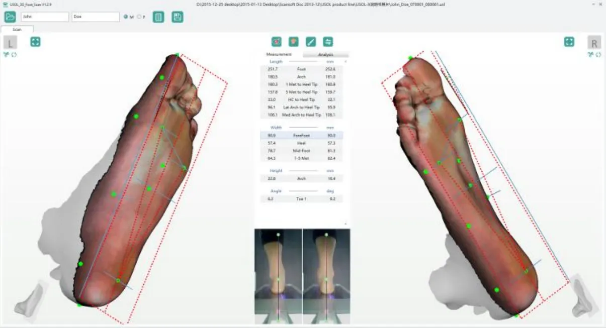 Ортопедический сканер ScanPod3D USOL-X Floor