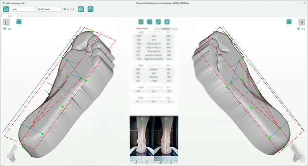 Ортопедический сканер ScanPod3D USOL-DUO