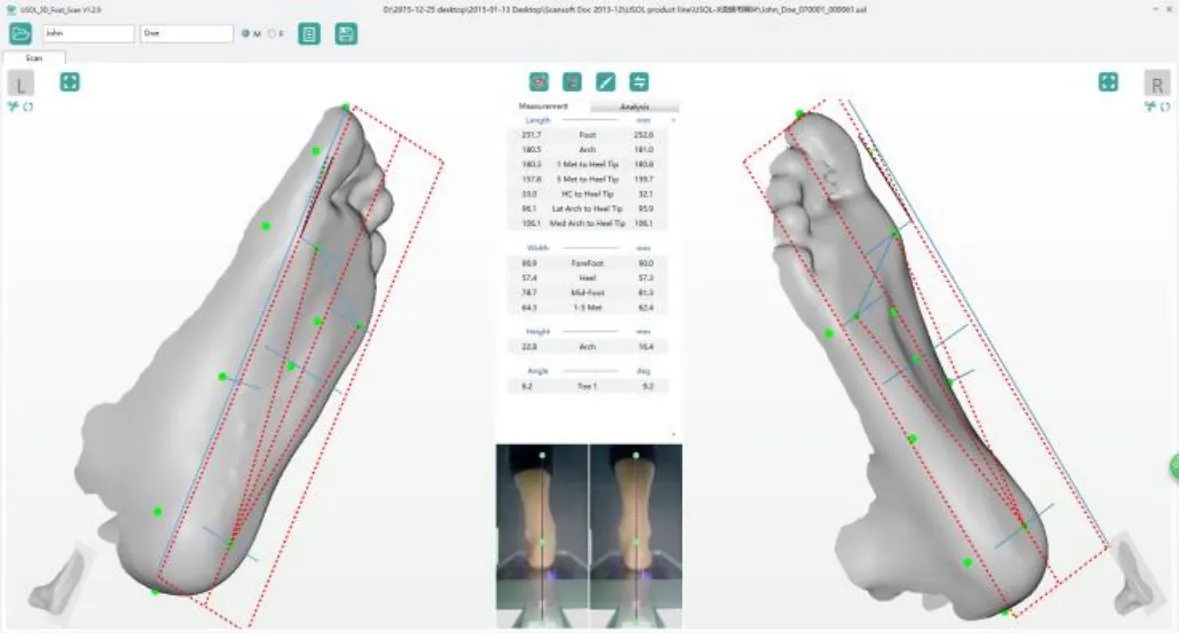 Ортопедический сканер ScanPod3D USOL-X Floor