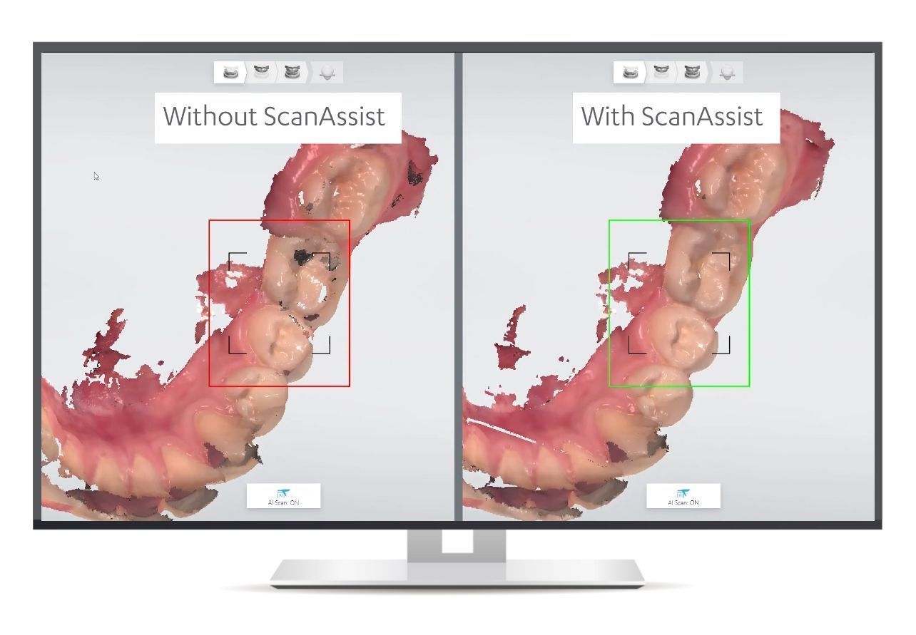Интраоральный 3D-сканер 3Shape TRIOS 5