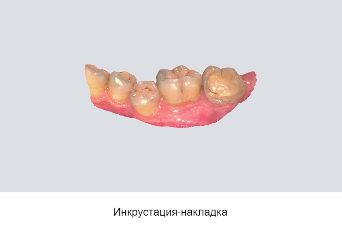 14shining3.jpeg 14shining3.jpeg