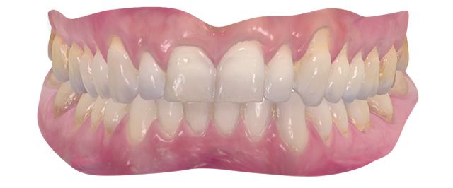 3d-skaner-3shape-trios-wireless-3.jpg 3d-skaner-3shape-trios-wireless-3.jpg