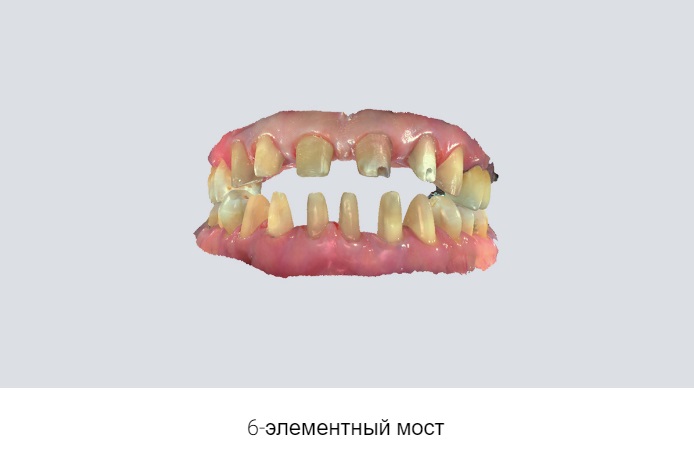 16shining3.jpeg 16shining3.jpeg