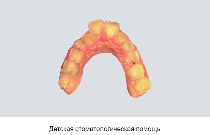 12shining3.jpeg 12shining3.jpeg