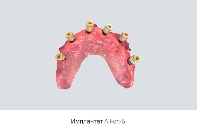 15shining3.jpeg 15shining3.jpeg