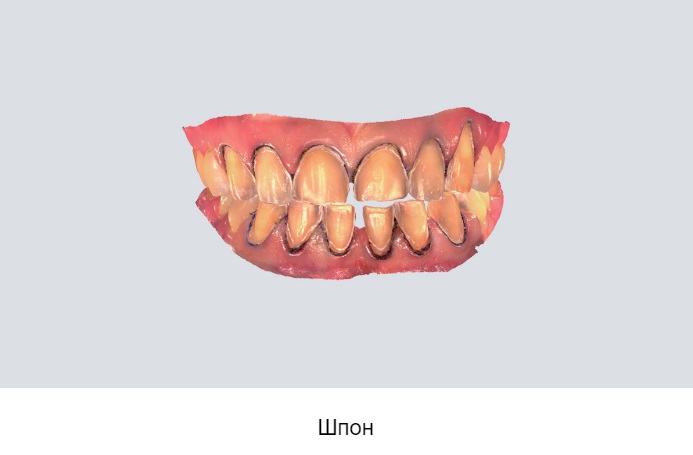 17shining3.jpeg 17shining3.jpeg