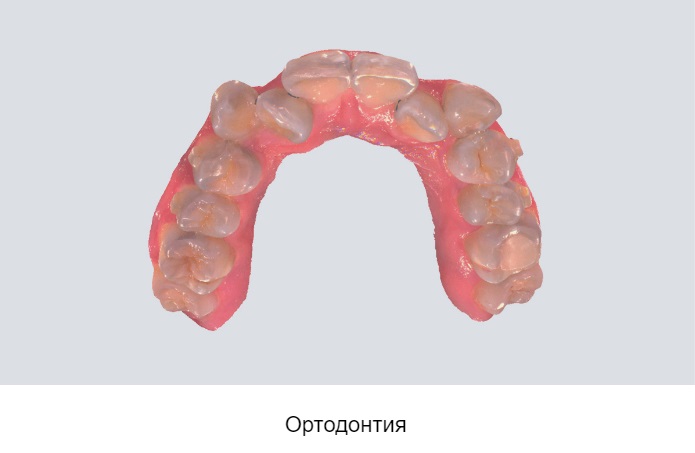 13shining3.jpeg 13shining3.jpeg